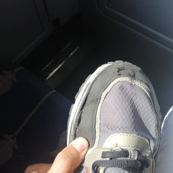 Yüksek Fiyatlı Skechers Ayakkabıda Erken Deformasyon Ve Garanti Reddi Hayal Kırıklığı Yarattı