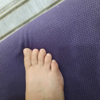 Yeni Alınan Sandalet Ayağımı Yaraladı, İade Talep Ediyorum