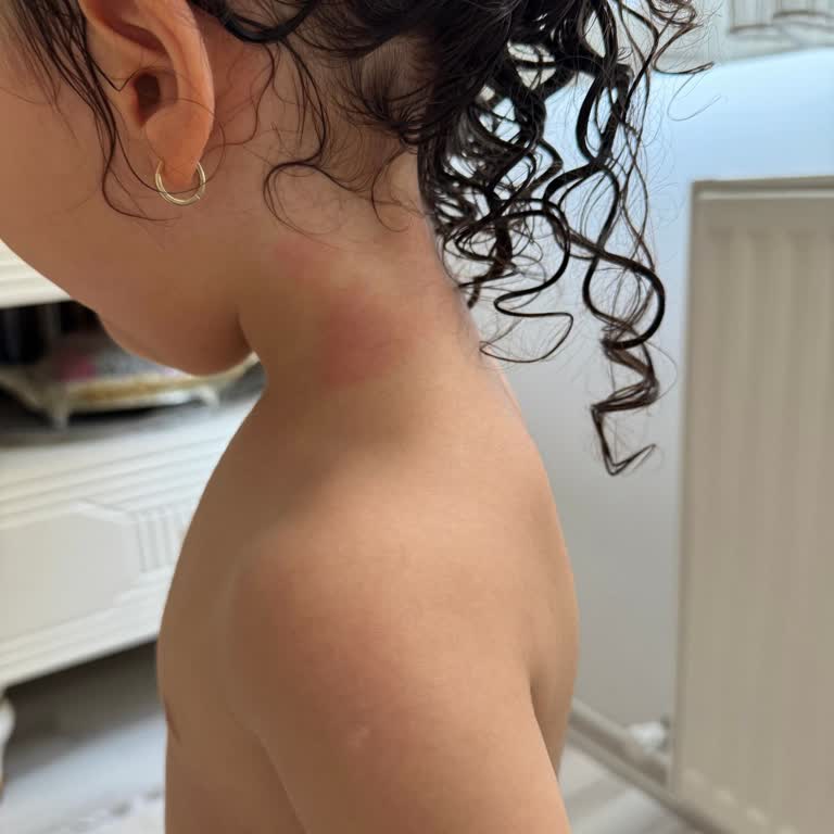 Uni Baby Şampuan Kızımda Cilt Kızarıklığına Neden Oldu