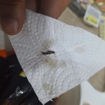 Midyeci Ahmet Siparişimde Hijyen Açısından Sınıfta Kaldı