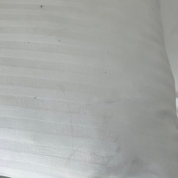 Otel Hijyeni Ve Müşteri Memnuniyeti Sıfır, 1 Günümüz Rezil Oldu