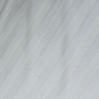 Otel Hijyeni Ve Müşteri Memnuniyeti Sıfır, 1 Günümüz Rezil Oldu