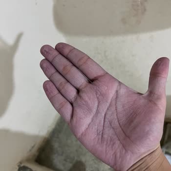 Aldığım Ürün Saçlarımı Mahvetti Çözüm Bekliyorum