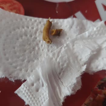 BİM'den Alınan Lahmacunun İçinden Yabancı Madde Çıkması Ve Sonrasında Yaşanan Sağlık Sorunu