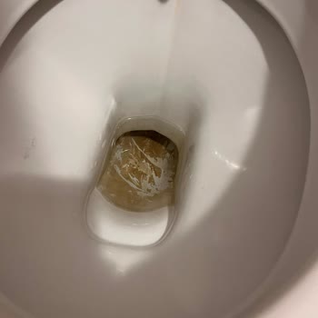 Minerva Port Otel'de Hijyen Sorunları Ve İlgisiz Yönetim