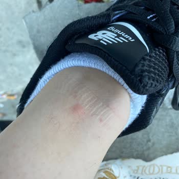 Mahallede Artan Pire Sorununa Çözüm Bekliyoruz