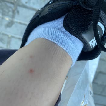 Mahallede Artan Pire Sorununa Çözüm Bekliyoruz