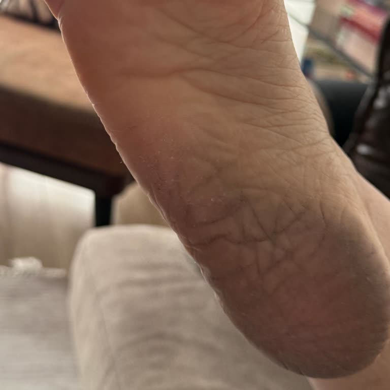 Sandalet Ayağımı Boyadı, Çözüm Sunulmuyor!