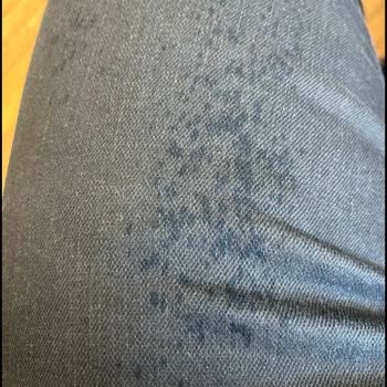 İlk Kullanımda Pantolonda Oluşan Hatalara Çözüm Bulunmadı