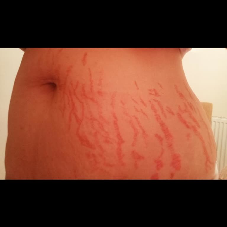 Sözler Tutulmadı, Hizmetten Memnun Kalmadım Ve Mağdur Edildim