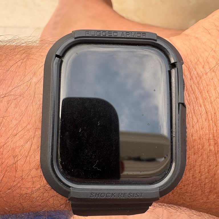 Spigen Apple Watch Kordonu Kısa Sürede Parçalandı, Garanti Desteği Sağlanmadı