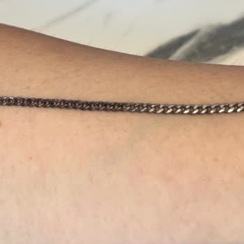 Hediye Bileklik Kısa Sürede Simsiyah Oldu Firma İlgisiz Ve Yargılayıcı Davrandı