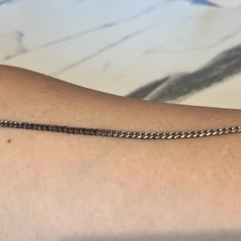 Hediye Bileklik Kısa Sürede Simsiyah Oldu Firma İlgisiz Ve Yargılayıcı Davrandı