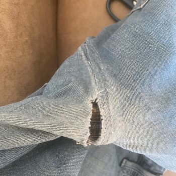 Mavi Pantolonlarda Tekrarlayan Yırtılma Sorunu