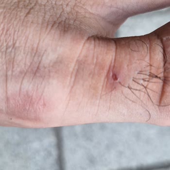 Aldığım Terlik Ayağımı Kesti, İade Talebim Reddedildi