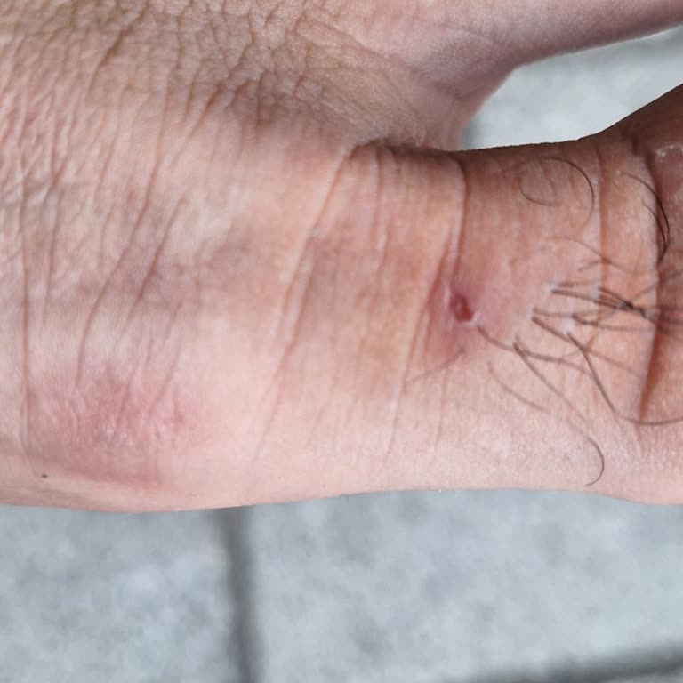 Aldığım Terlik Ayağımı Kesti, İade Talebim Reddedildi