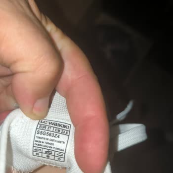 Kalitesiz Ayakkabı Nedeniyle Çocuğumun Yaşadığı Kaza Ve Güvenlik Endişesi