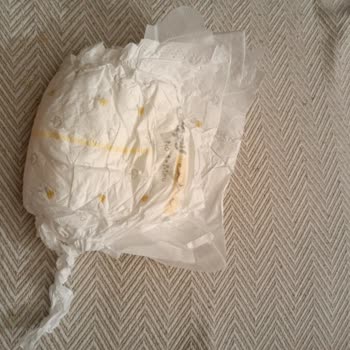 Sleepy 4 Numara Bebek Bezlerinde Sürekli Üretim Hataları Ve Mağduriyet