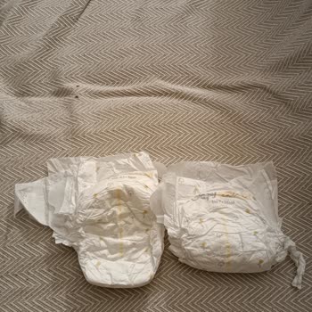 Sleepy 4 Numara Bebek Bezlerinde Sürekli Üretim Hataları Ve Mağduriyet