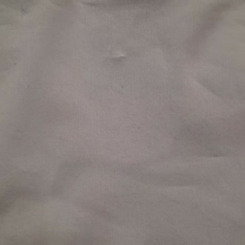 Tadilat Sonrası Deforme Olan Pantolon Ve İlgisiz Mağaza Deneyimi