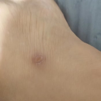 FLO Terlik İlk Günde Ayağımı Yaraladı, İade Talebim Reddedildi