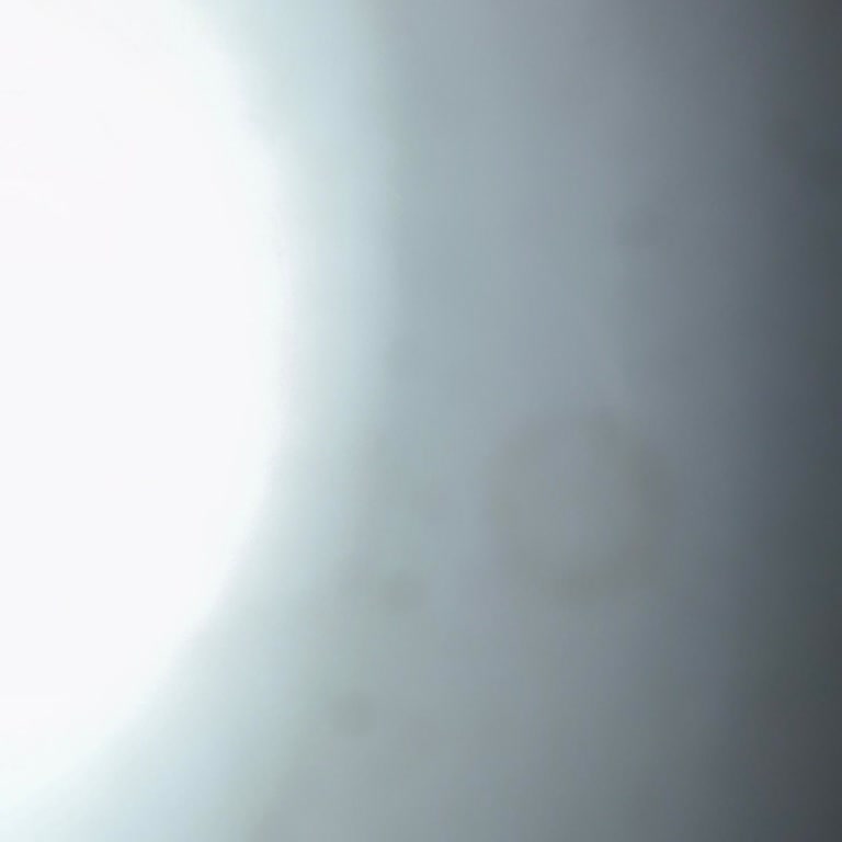 Kablo Net'te Sürekli Kesinti Ve Çözülmeyen Arıza