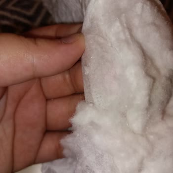 Bebek Bezi Sertlikleri Ve Sızdırma Sorunu