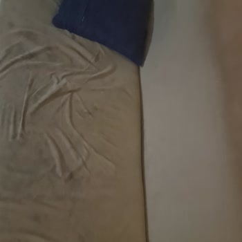 Refakatçi İçin Hijyen Ve Oturma Sorunu Yaşanıyor