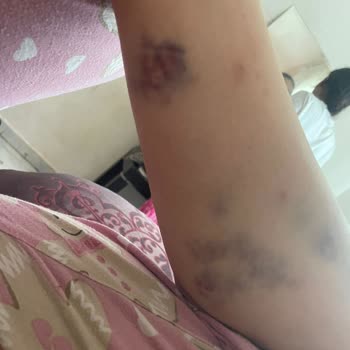 Eğitmen İlgisizliği Ve Mağduriyetimin Dikkate Alınmaması