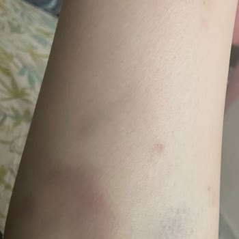 Eğitmen İlgisizliği Ve Mağduriyetimin Dikkate Alınmaması