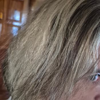 Ombre İşlemi Sonrası Saçlarım Zarar Gördü