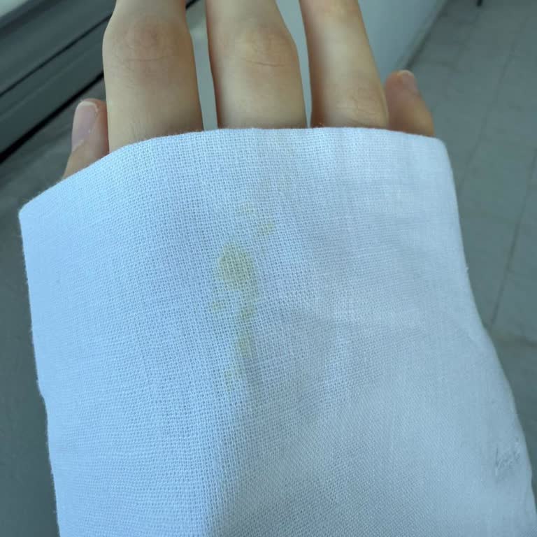 Jorbinol Kusurlu Ürün Ve Eksik İade Süreci Mağduriyeti