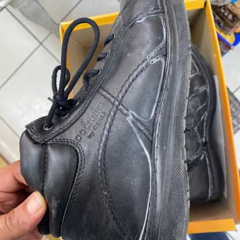 Dockers Botta Tekrarlayan Beyaz Leke Sorunu Ve Yetersiz İnceleme