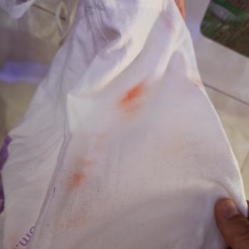 FLO'da Hatalı Taksit İşlemi Ve Kalitesiz Alışveriş Çantası Nedeniyle Mağduriyet