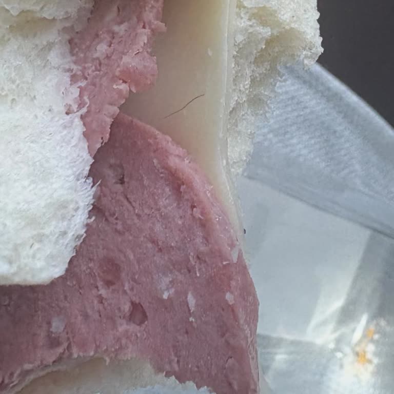 Sandviçte Kıl Buldum Hijyen Sorunu Yaşadım Paramı Geri İstiyorum