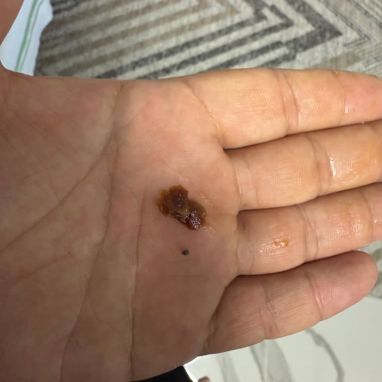 Simbat Gün Kurusunda Çakıl Taşı: Oğlumun Dişi Kırıldı