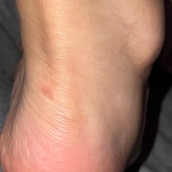 Vans Ayakkabı Her Giyişte Ayağımı Yara Yaptı, Acıdan Topal Geziyorum