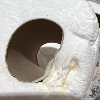 Küflü Ürün Ve Yetersiz Müşteri Hizmeti Nedeniyle Para İadesi Talebi