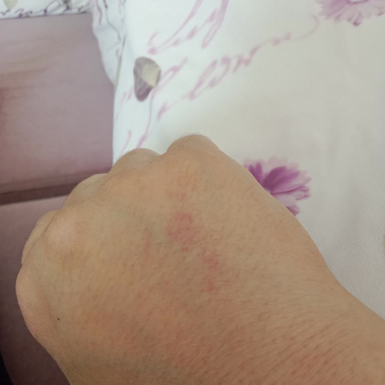 Enza Güzellik Merkezleri Fazla Para Çekimi Ve Şiddetli Davranış