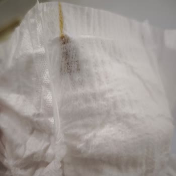 Molfix Bebek Bezinde Yabancı Maddeyle Karşılaşınca Şok Oldum