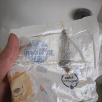 Molfix Bebek Bezinde Yabancı Maddeyle Karşılaşınca Şok Oldum