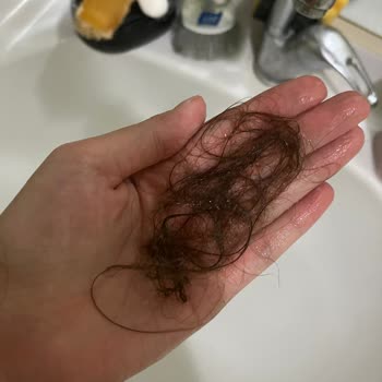 OGX Brazilian Keratin Smooth Şampuan Saç Dökülmesi Ve Sağlık Sorunları