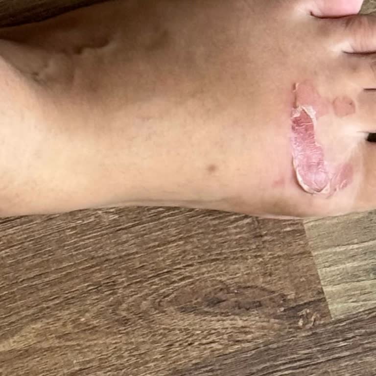 Ayakkabı İncelemesi Sonucu Mağduriyetim Giderilmedi