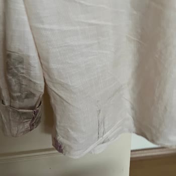 Yedpa Opet'te Temizlik İhmali Sonucu Yaşanan Kaza Ve İlgisiz Yaklaşım