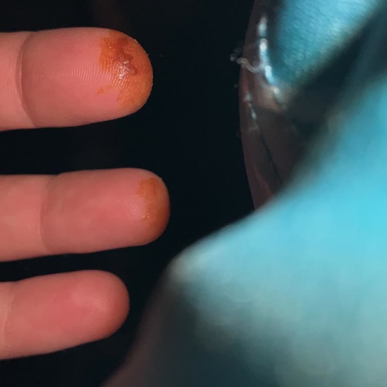 Beeo Sıvı Propolis Hem Glikozlu Hem Pütürlü Çıktı