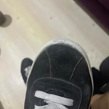Lacoste Ayakkabının 5 Ayda Soyulması Ve Garanti Reddi