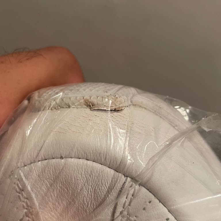 Üçüncü Kullanımda Açılan Ayakkabı Ve Reddedilen Garanti Talebi Mağduriyeti
