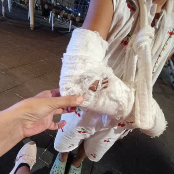 Kızımın Kırık Kolu İçin Yapılan Hatalı Alçı Uygulaması