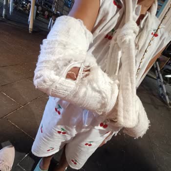 Kızımın Kırık Kolu İçin Yapılan Hatalı Alçı Uygulaması