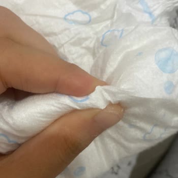 Bebek Bezi Ürün Güvenliği Hakkında Şikayet